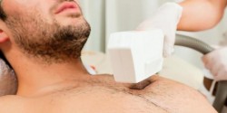 Triệt lông vùng ngực