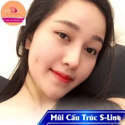 Tạo má lún đồng tiền