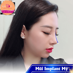 Nâng mũi sline HQ sóng tự nhiên, siêu mềm (BH trọn đời)