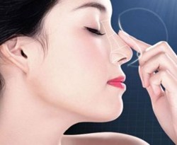 Nâng mũi sline HQ sóng thường