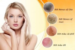 Điều trị bớt - tràm 100%