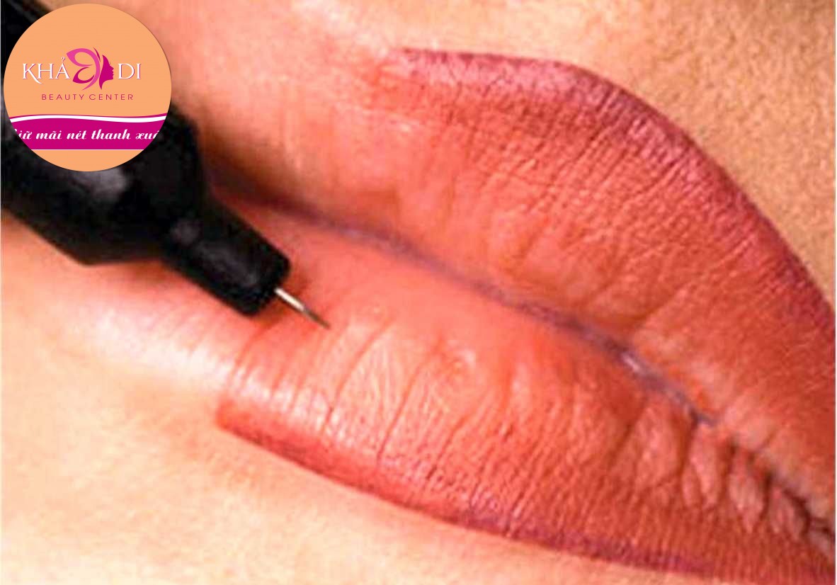 Phun xóa sữa môi