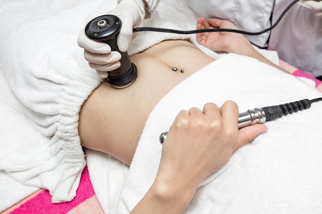 Giảm mỡ không phẩu thuật Lipo hifu ( Vùng bụng, vai sau áo ngực, bắp tay, đùi, bắp chân,...