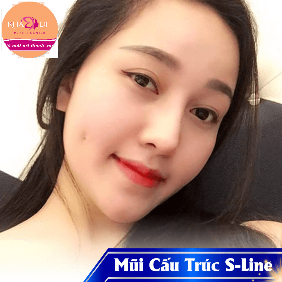 Tạo má lún đồng tiền