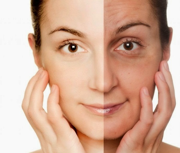 Lấy mỡ mí dưới