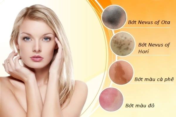 Điều trị bớt - tràm 100%